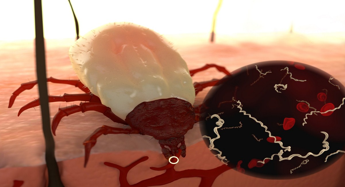 Lyme Disease